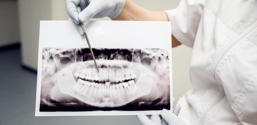 medico indica i denti